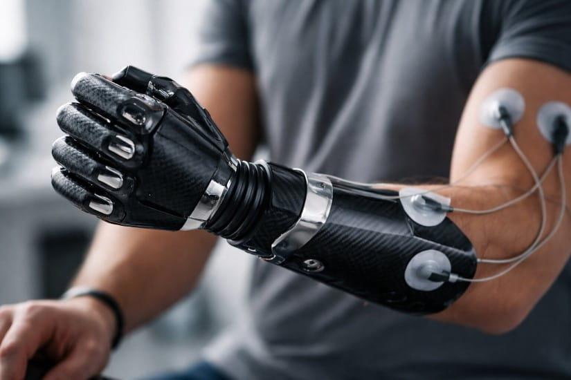 Biyonik El Nasıl Çalışır?