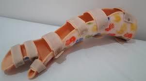 El Bilek Dirsek Splinti